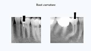 Endodontics from A to Z series 1Basics [upl. by Bosson662]