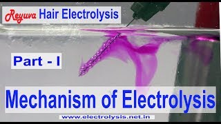 How Hair Electrolysis works [upl. by Ajin]