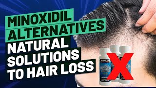 Minoxidil Alternatives  Natural Solutions to Hair Loss [upl. by Girand642]