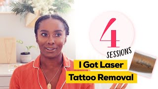 Amazing Laser Tattoo Removal Results [upl. by Isaacson542]