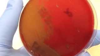 Microbiology  Hemolysis [upl. by Winebaum702]