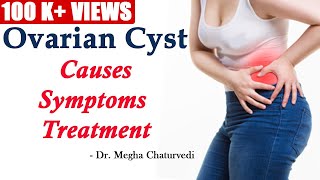 What You Need to Know About Ovarian Cysts [upl. by Kola]