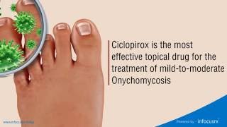 Ciclopirox is the most effective topical drug for the treatment of mildtomoderate Onychomycosis [upl. by Nallid434]