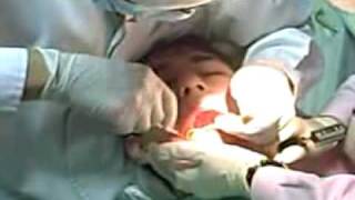 Dental Cyst and Infection Causes Symptoms Types and Treatment [upl. by Nomde641]