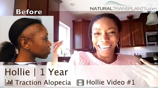 Hair Loss Treatment for Women Result  Traction Alopecia Hair Loss Treatment Result Hollie [upl. by Assiruam]