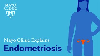 Mayo Clinic Explains Endometriosis [upl. by Karb]