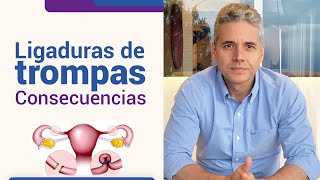 Consecuencias de la ligadura de trompas l Dr Juan Luis Giraldo [upl. by Frymire]