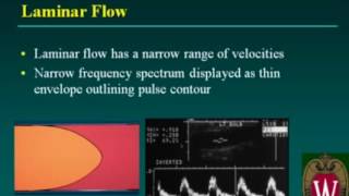 Carotid Artery Pulse Vs Jugular Venous Pulse  Physiology [upl. by Elockin]