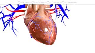 How does aspirin work [upl. by Dickson]