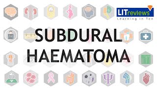 Subdural Haematoma [upl. by Eical]