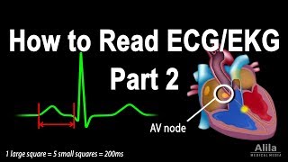 How to Read ECGEKG Part 2 Animation [upl. by Dorelia]