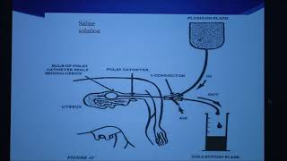 ES cell microinjection into a mouse blastocyst [upl. by Maurise]