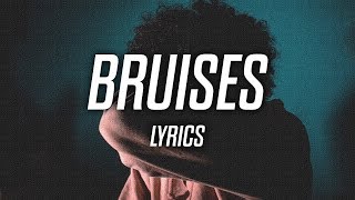 SadBoyProlific  Bruises Lyrics  Lyric Video [upl. by Aenil]