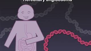 Treating Hereditary Angioedema [upl. by Alohcin]